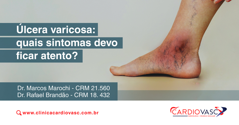 Crema anti-varicoasa ort